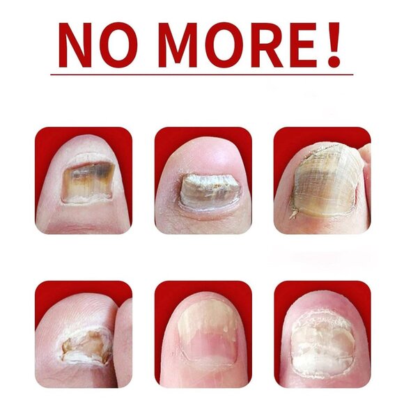 Ginger Nail Treatment Oil –Nail Growth & Cuticle Care (2pcs, 1 fl. oz each) - Picture 5 of 7